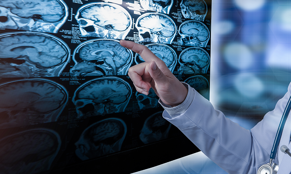 A provider points at a screen showing brain imaging of a patient, as an illustration of treatment options for multiple sclerosis.
