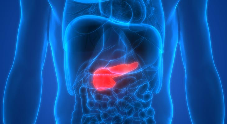 Pancreatic adenocarcinoma study published in Annals of Surgical ...