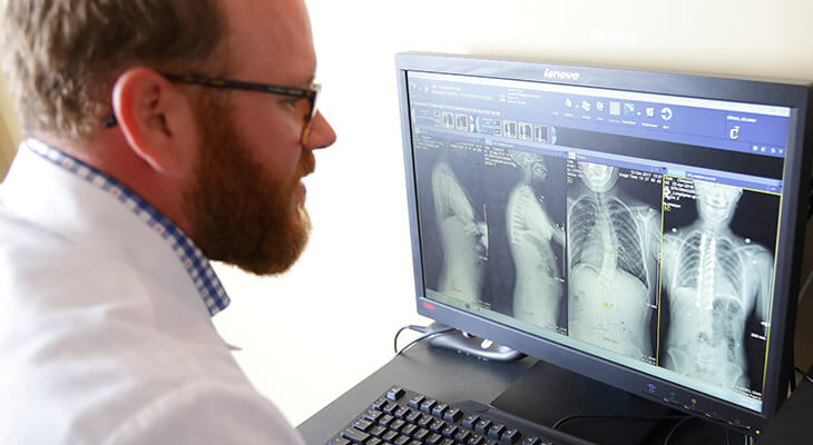 Norton Leatherman Spine physicians to present at Scoliosis