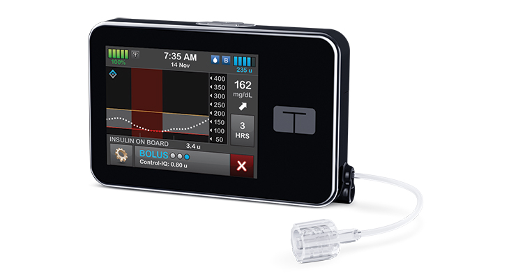 Continuous glucose monitors are changing lives - Norton Healthcare Provider  Louisville, Ky.